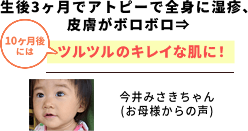 生後3ヶ月でアトピーで全身に湿疹、皮膚がボロボロ→10ヶ月後にはツルツルの綺麗な肌に