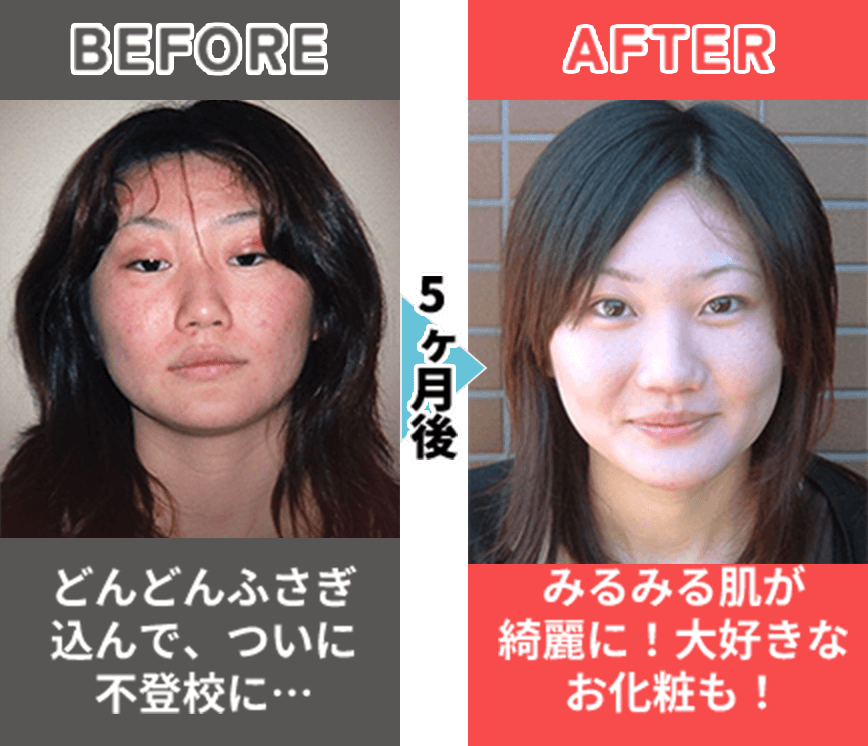 Before After