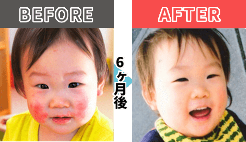 Before After